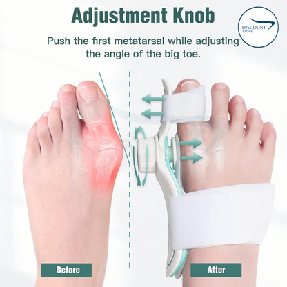 Pain Relief Bunion Toe Corrector - (IMPORTED W/O KNOB)