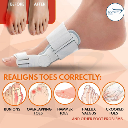Pain Relief Bunion Toe Corrector - (IMPORTED W/O KNOB)